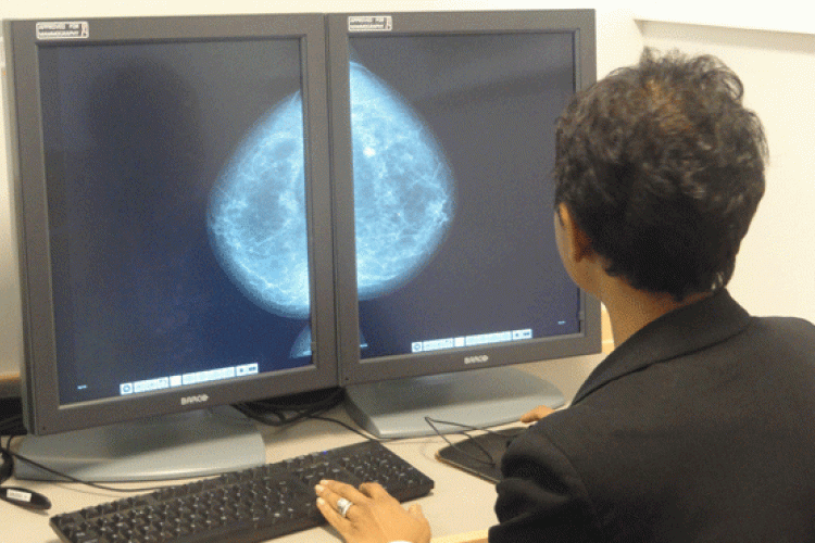 radiographer viewing breast image