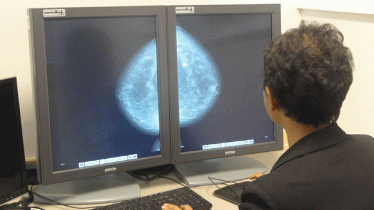 radiographer viewing breast image