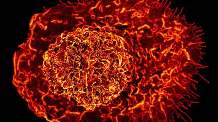 Scanning electron micrograph of a macrophage